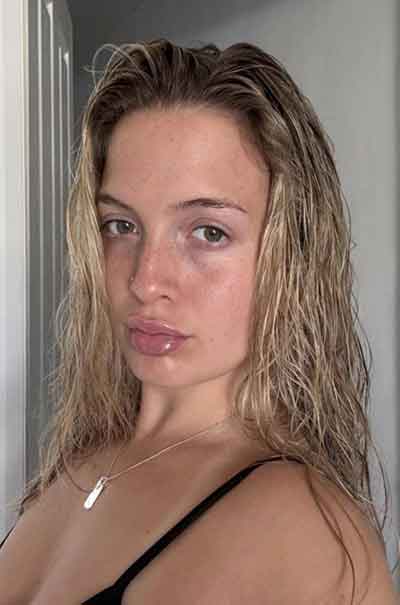 Amalie, 29 år